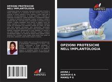 Borítókép a  OPZIONI PROTESICHE NELL'IMPLANTOLOGIA - hoz
