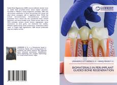 Обложка BIOMATERIALS IN PERI-IMPLANT GUIDED BONE REGENERATION