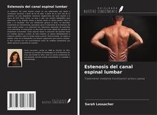 Borítókép a  Estenosis del canal espinal lumbar - hoz