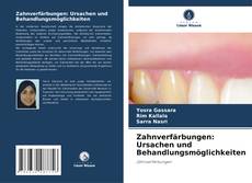 Zahnverfärbungen: Ursachen und Behandlungsmöglichkeiten的封面