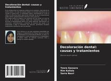 Decoloración dental: causas y tratamientos的封面