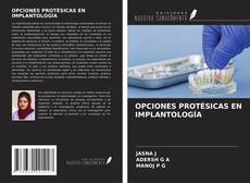 Borítókép a  OPCIONES PROTÉSICAS EN IMPLANTOLOGÍA - hoz