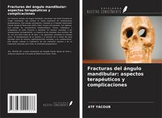 Fracturas del ángulo mandibular: aspectos terapéuticos y complicaciones的封面