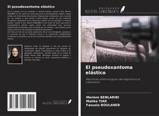Borítókép a  El pseudoxantoma elástico - hoz