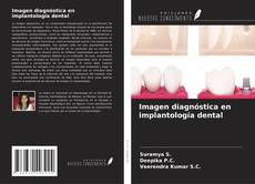 Borítókép a  Imagen diagnóstica en implantología dental - hoz