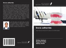 Borítókép a  Encía adherida - hoz