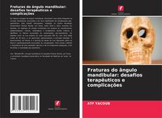 Capa do livro de Fraturas do ângulo mandibular: desafios terapêuticos e complicações 