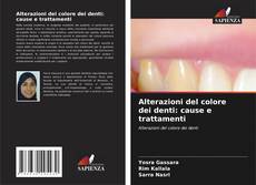 Bookcover of Alterazioni del colore dei denti: cause e trattamenti