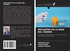 Bookcover of IMPLANTES EN LA BASE DEL CRÁNEO