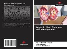 Buchcover von Lupus in Men: Diagnosis and Management