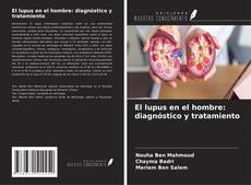 Обложка El lupus en el hombre: diagnóstico y tratamiento