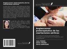 Capa do livro de Angioscanner preterapéutico de las coartaciones aórticas 