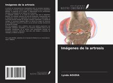 Capa do livro de Imágenes de la artrosis 