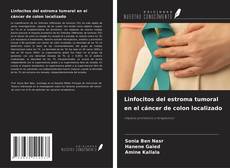 Borítókép a  Linfocitos del estroma tumoral en el cáncer de colon localizado - hoz