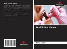Oral lichen planus kitap kapağı