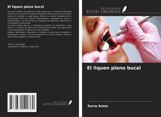 Borítókép a  El liquen plano bucal - hoz
