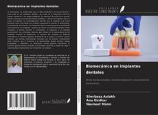Borítókép a  Biomecánica en implantes dentales - hoz