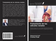 Bookcover of Tratamiento de los cálculos renales