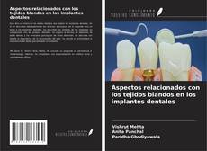 Borítókép a  Aspectos relacionados con los tejidos blandos en los implantes dentales - hoz
