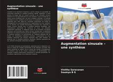 Borítókép a  Augmentation sinusale – une synthèse - hoz