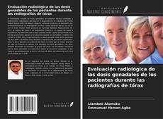 Buchcover von Evaluación radiológica de las dosis gonadales de los pacientes durante las radiografías de tórax