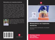 Bookcover of Biomecânica em implantes dentários