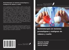 Copertina di Quimioterapia en lesiones premalignas y malignas de cabeza y cuello