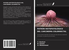 Portada del libro de PATRÓN HISTOPATOLÓGICO DEL CARCINOMA COLORRECTAL