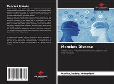 Menckes Disease kitap kapağı