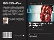 Borítókép a  Electrocardiograma y SCA, atrapados en la interpretación - hoz