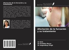 Bookcover of Afectación de la furcación y su tratamiento
