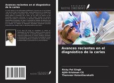 Borítókép a  Avances recientes en el diagnóstico de la caries - hoz