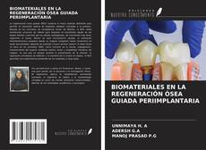 BIOMATERIALES EN LA REGENERACIÓN ÓSEA GUIADA PERIIMPLANTARIA的封面