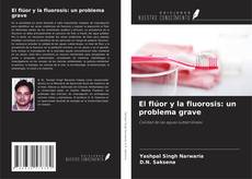 Copertina di El flúor y la fluorosis: un problema grave