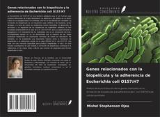 Capa do livro de Genes relacionados con la biopelícula y la adherencia de Escherichia coli O157:H7 