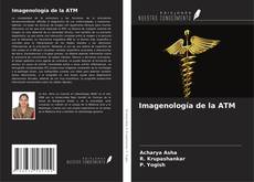 Borítókép a  Imagenología de la ATM - hoz