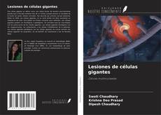 Buchcover von Lesiones de células gigantes