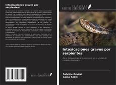 Intoxicaciones graves por serpientes: kitap kapağı
