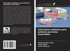 Soluciones estéticas para prótesis parciales removibles的封面