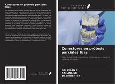 Обложка Conectores en prótesis parciales fijas