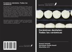 Bookcover of Cerámicas dentales: Todas las cerámicas
