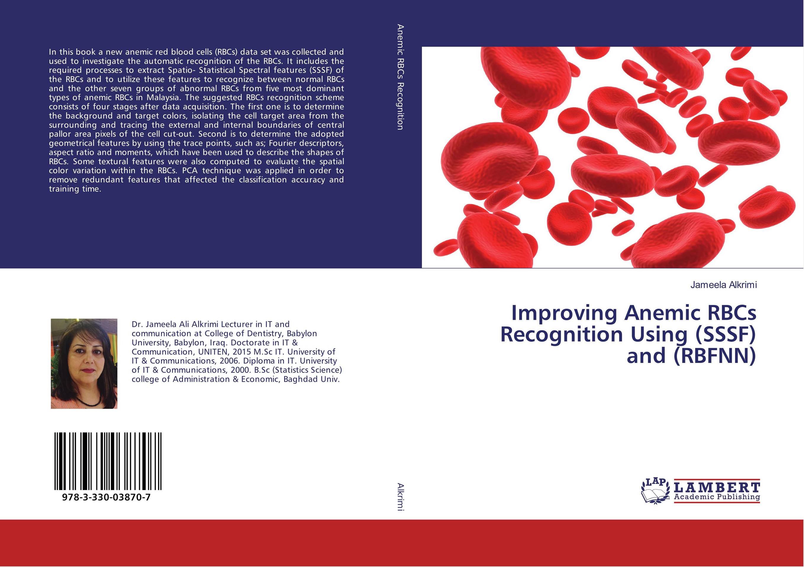 Improving Anemic RBCs Recognition Using (SSSF) and (RBFNN)..