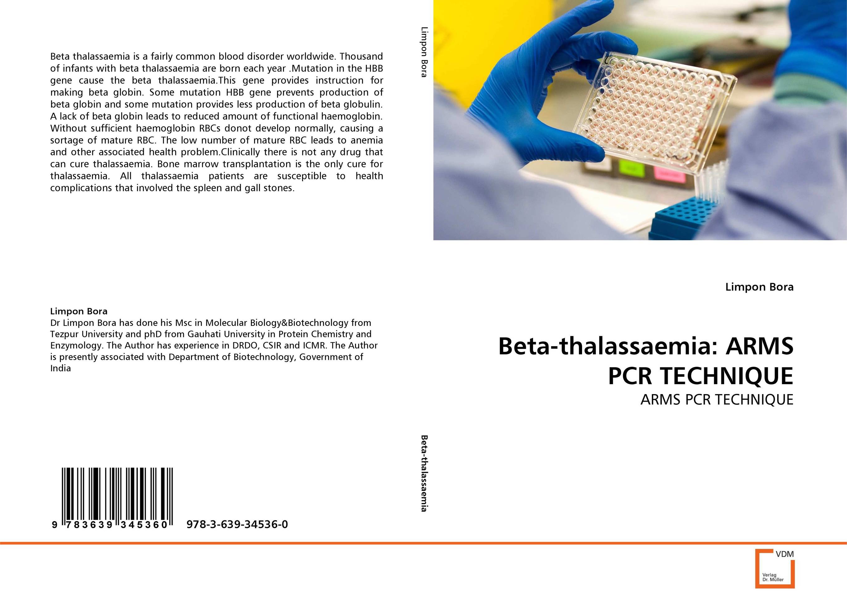 Beta-thalassaemia: ARMS PCR TECHNIQUE. ARMS PCR TECHNIQUE.