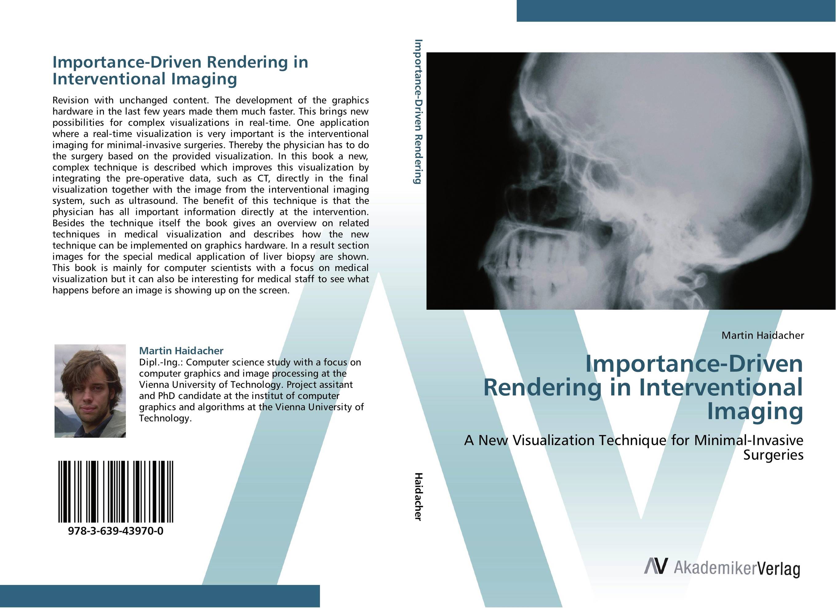 Importance-Driven Rendering in Interventional Imaging. A New Visualization Technique for Minimal-Invasive Surgeries.
