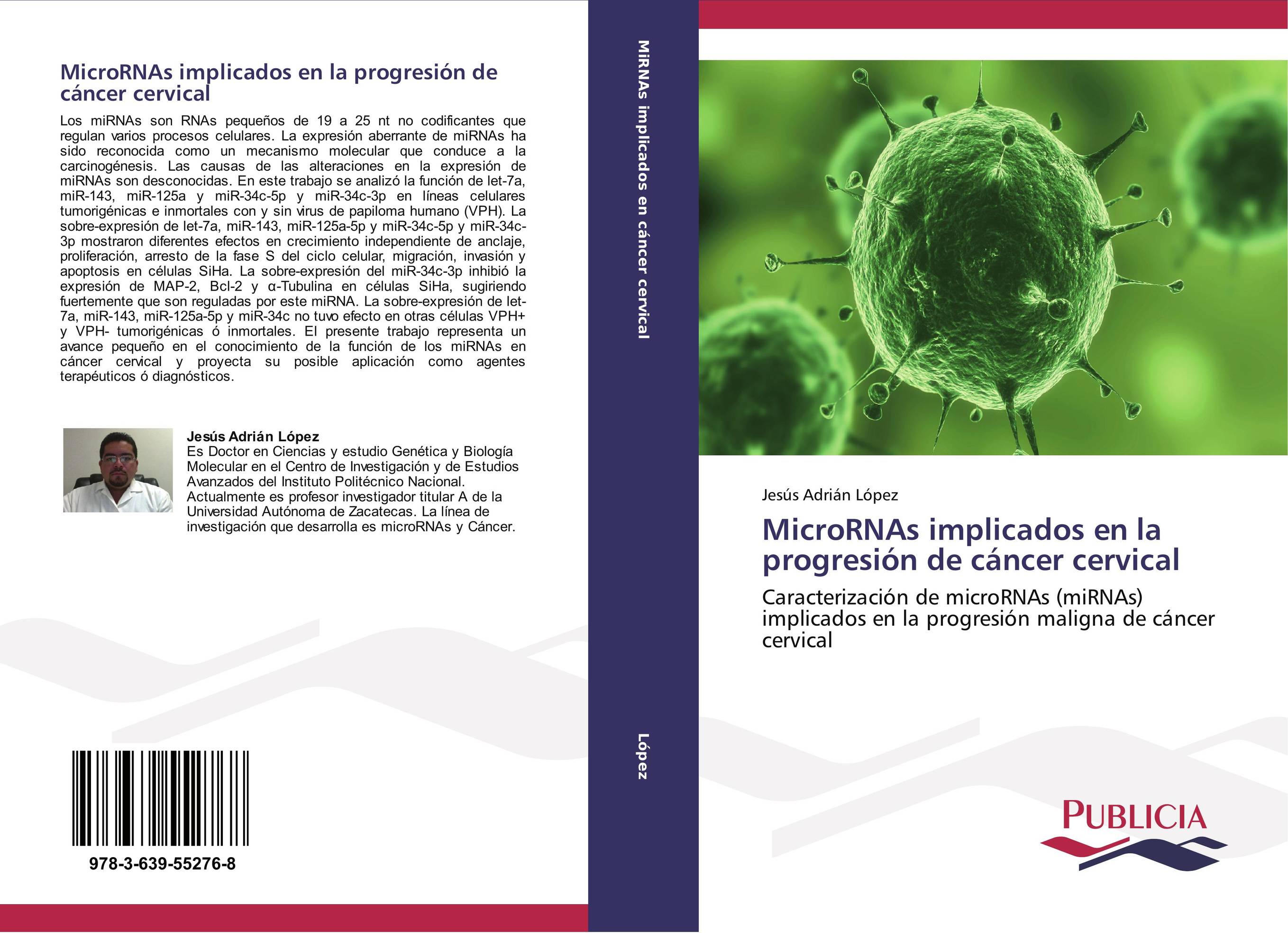 MicroRNAs implicados en la progresión de cáncer cervical