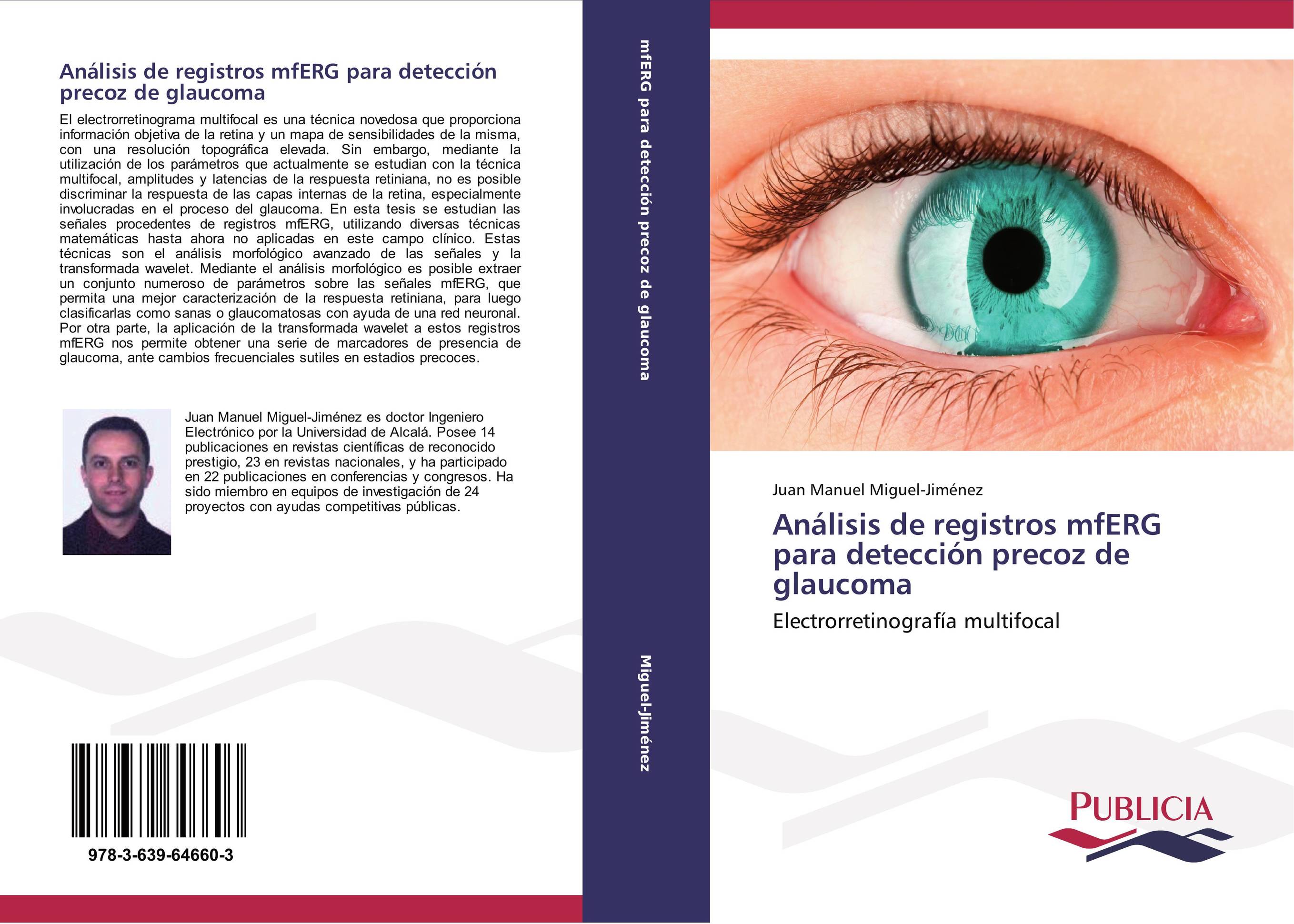 Análisis de registros mfERG para detección precoz de glaucoma