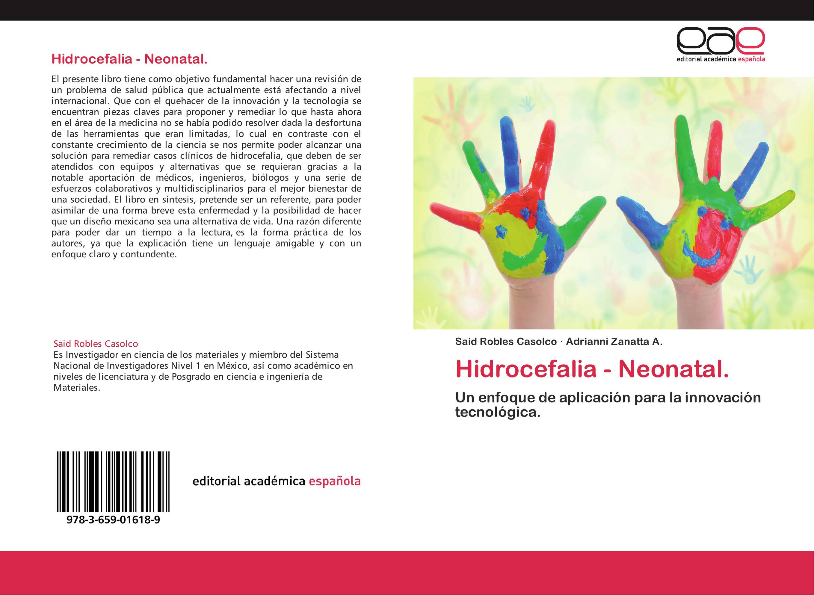 Hidrocefalia - Neonatal.