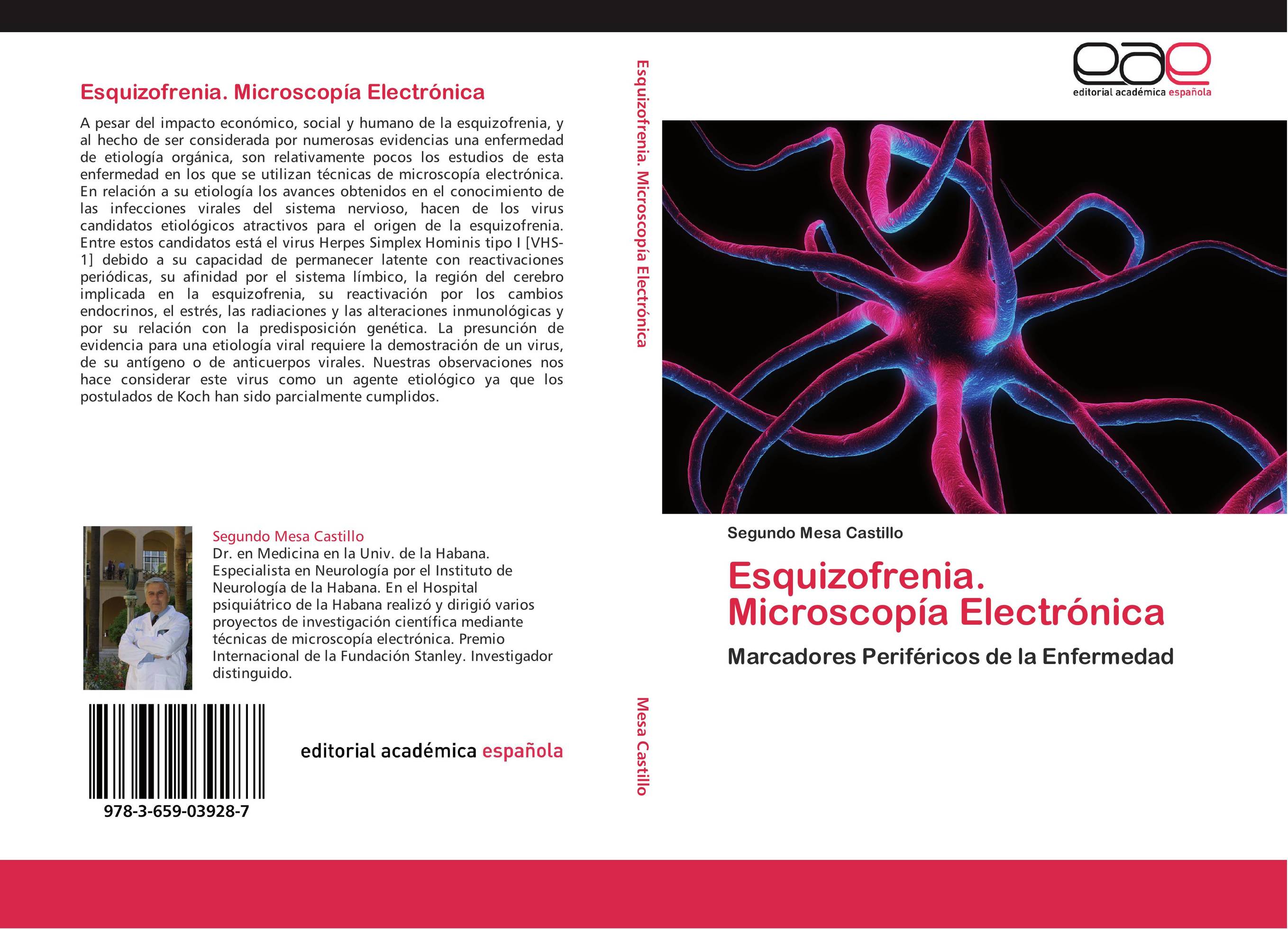 Esquizofrenia. Microscopía Electrónica