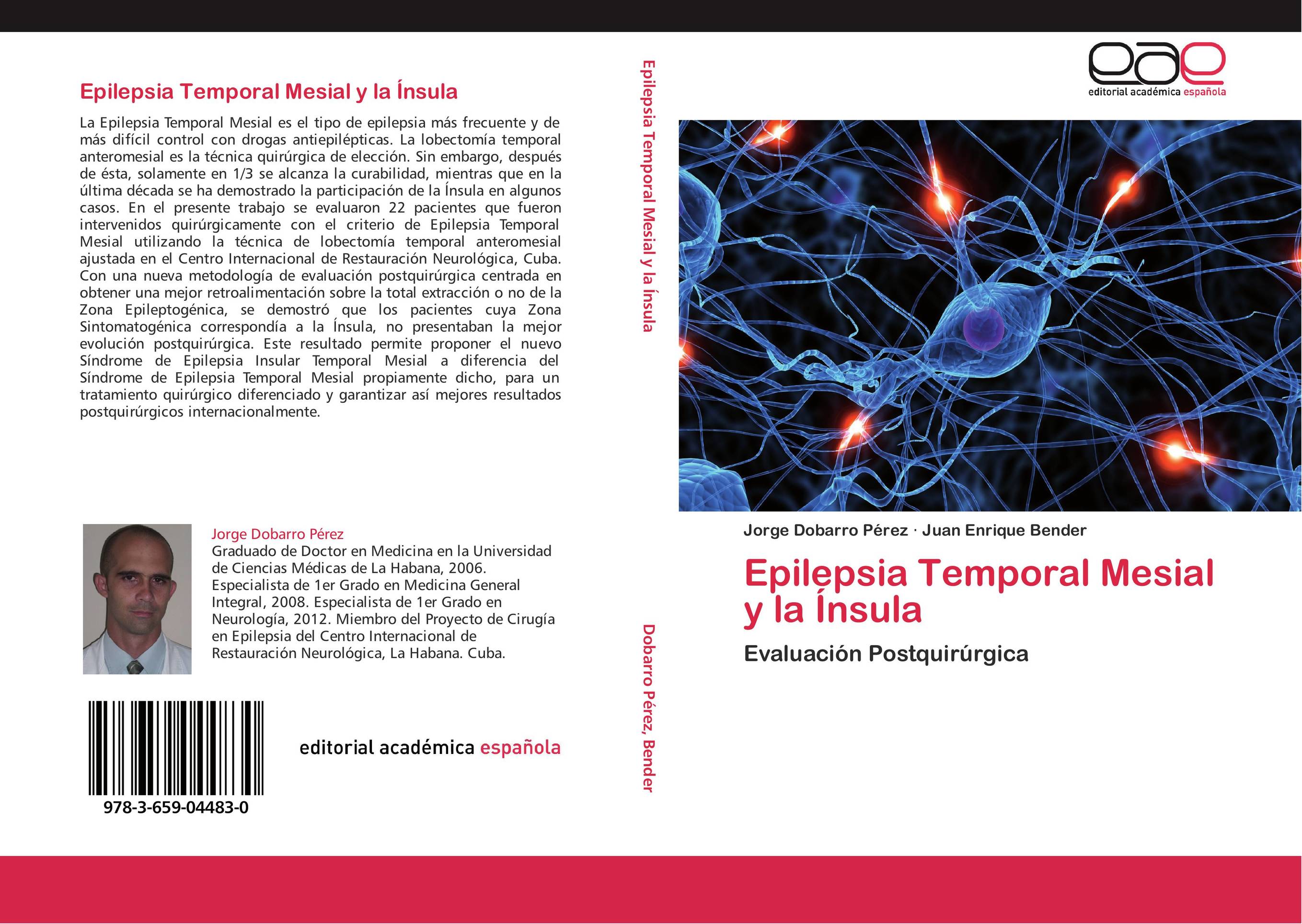 Epilepsia Temporal Mesial y la Ínsula