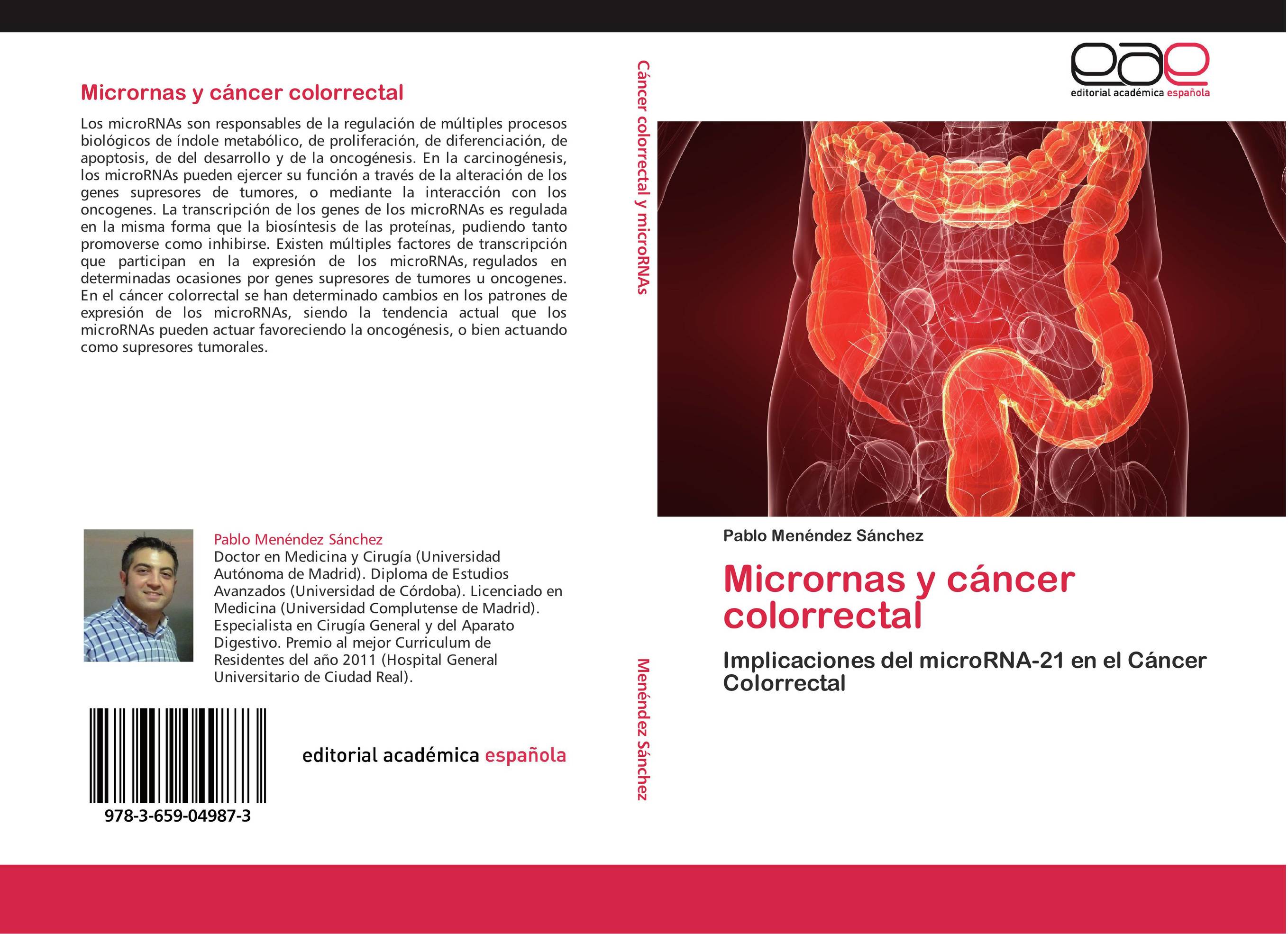 Micrornas y cáncer colorrectal
